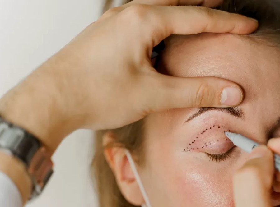 cosmetic_surgery